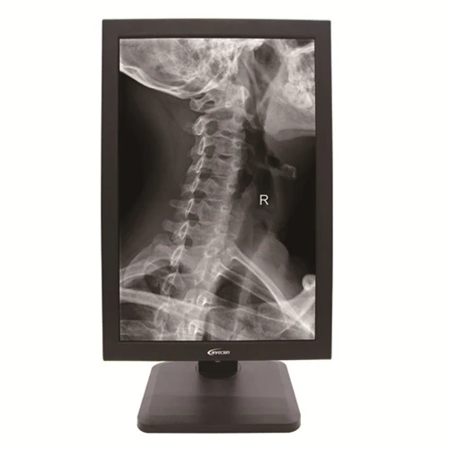19,6 Zoll Graustufen 2M medizinischer Monitor
